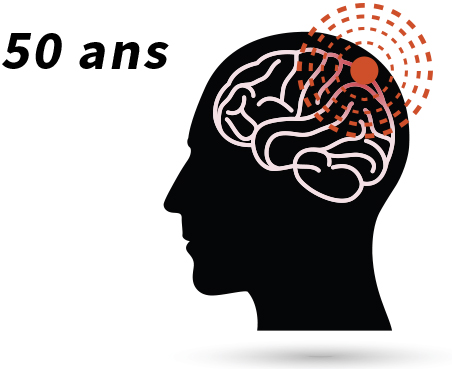 La maladie à corps de Lewy en chiffres