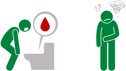 Tout savoir sur la colite ulcéreuse